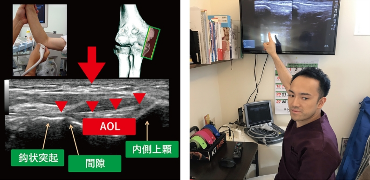 最新画像検査（エコー）