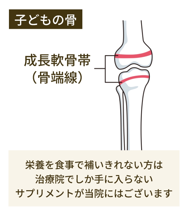 骨端線（成長線）